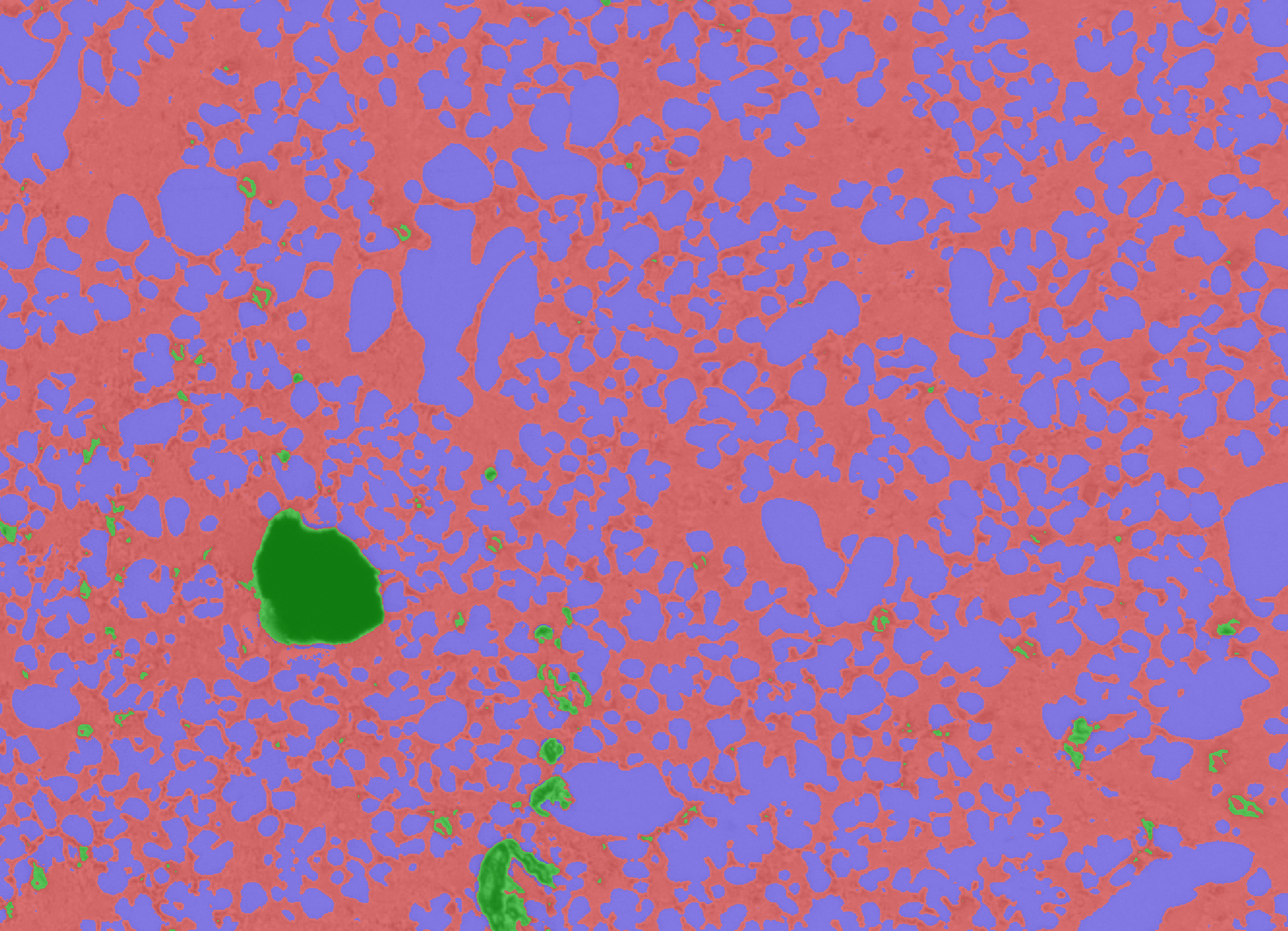 Image analysis for microscopy made simple with machine learning clemex